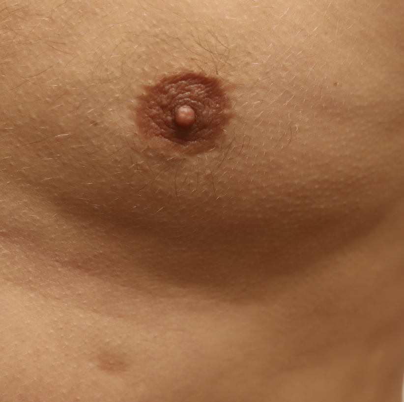 Male accessory nipple